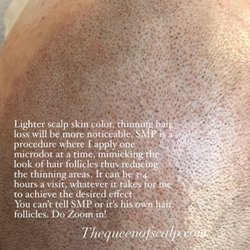 SMP Hair Clinic The Queen Of Scalp