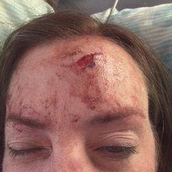 Berkshire Medical Center - Why I went