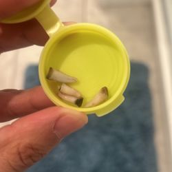 Pediatric Dental Specialists - Got 4 teeth distracted
