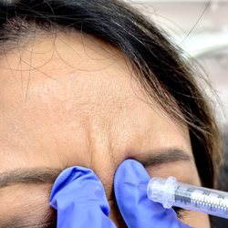 Endeavor Wellness and Medspa - We offer Botox and other dermal fillers to reduce wrinkles and fine lines, PRP facials and other customized restorative beauty treatment