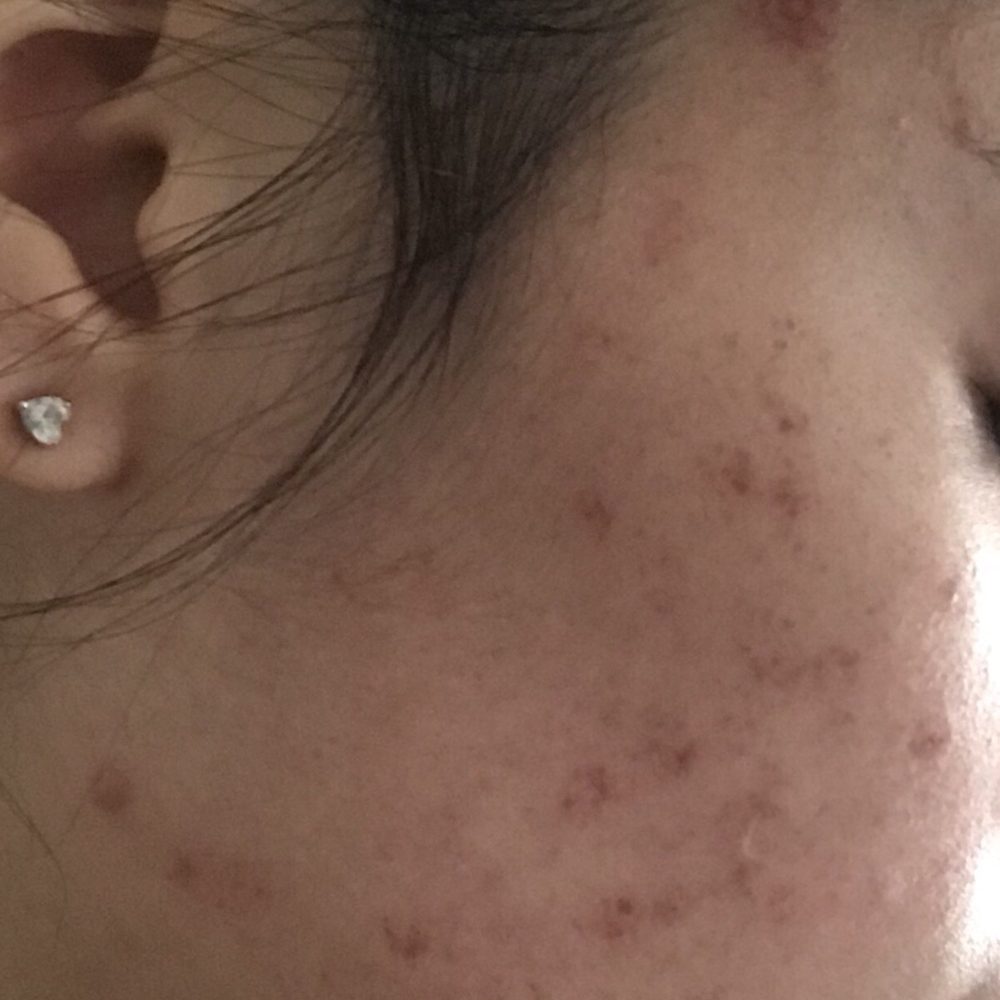 James Y. Wang, MD - Dermatologists Near Me - Los Angeles, California James Y. Wang, MD - Dermatologists Near Me - Los Angeles, California