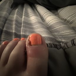 Big toe infected. Big toe infected.