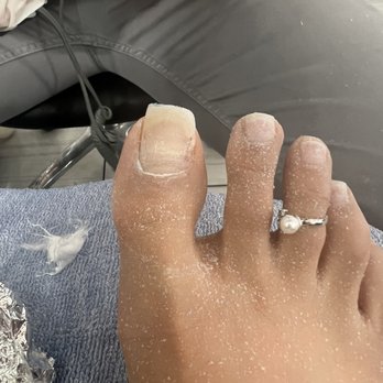 Polishhd Nail Bar - 4 months grown out! Had to have acrylic the WHOLE TIME for it to Heal and now it's permanently damaged on the right side of the nail!! - Nail Salons Near Me - Phoenix, Arizona