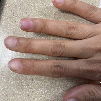 T & T Nail Spa - My ruined nail top is complete filled off with nail drill painful and red - Nail Salons Near Me - Tarzana, California