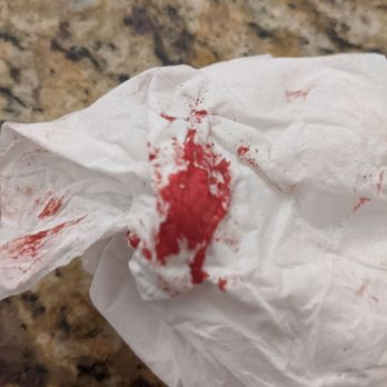 Petco - Blood after 3 hrs - Pet Training Near Me - Holyoke, Massachusetts