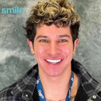 Smile the Spa - Our patient Vincent after Kör Whitening at Smile The Spa, the best Cosmetic Dentistry in Long Beach (CA). - Cosmetic Dentists Near Me - Long Beach, California Smile the Spa - Our patient Vincent after Kör Whitening at Smile The Spa, the best Cosmetic Dentistry in Long Beach (CA). - Cosmetic Dentists Near Me - Long Beach, California