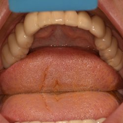 National Dental Bronx