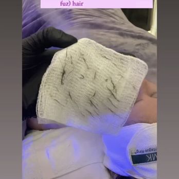 Sugarface Skincare - Amazing Facial Dermaplane! - Skin Care Near Me - Beverly Hills , California Sugarface Skincare - Amazing Facial Dermaplane! - Skin Care Near Me - Beverly Hills , California