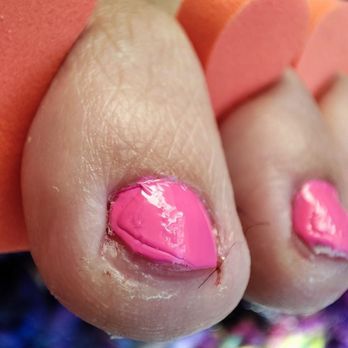 Nail lovers - How my toes looked post pedicure - Nail Salons Near Me - Miami, Florida