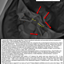 Digital Motion Xray - Auto Whiplash Injury:  APOM Coronal flexion demonstrating Catastrophic Failure of the Alar and/or Accessory Ligaments.