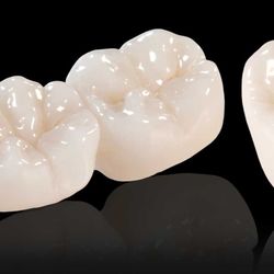 Johns Creek Family and Cosmetic Dentistry - At "Johns Creel Family & Cosmetic Dentistry" we use only the best material for our crowns. They are guaranteed not to beak!