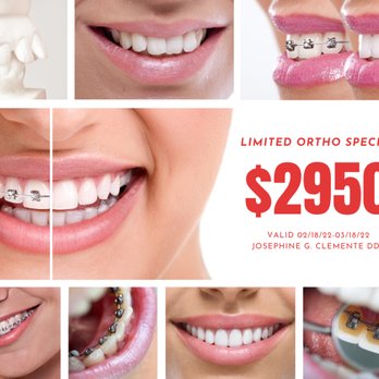 Josephine G Clemente, DDS - Take advantage of this deal!   (408)216-90372211 Moorpark Ave Ste 150 San Jose,CA - General Dentistry Near Me - San Jose, California