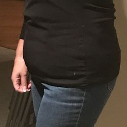 ACG Plastic Surgery- Dr. Alexandra Conde Green - After weight loss - 180 lbs