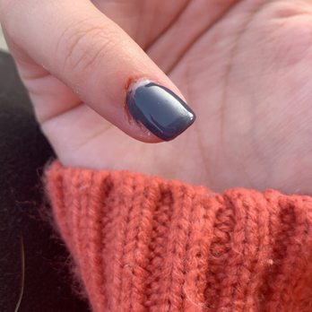 Nail Studio & Bar - Another picture of the gouge - Nail Salons Near Me - Depew, New York