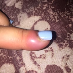 D K Nails - Bad !! Look what they did to my finger !!! They cut it and didn't even clean the cut ,