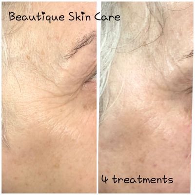 BEAUTIQUE SKIN CARE AND BODY STUDIO - 94 Photos - 340 S Wood Ave