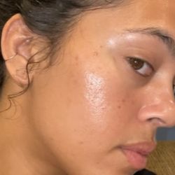 Skin Harmonics - After and still working with her :)