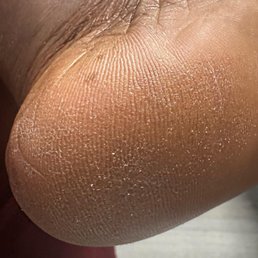 My heel right after the pedicure My heel right after the pedicure