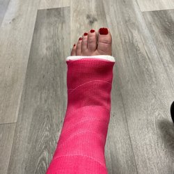 Fallbrook-Temecula Valley Orthopaedic Associates - Cast