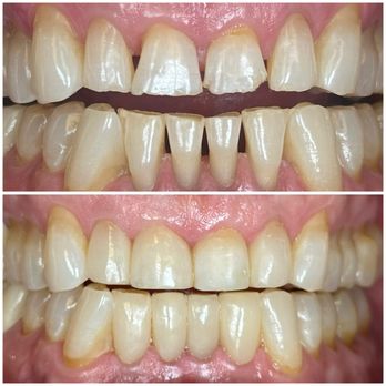 Affinity Smiles - General Dentistry Near Me - Skokie, Illinois Affinity Smiles - General Dentistry Near Me - Skokie, Illinois