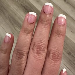 Picture taken the following day. You can see how my fingers are still bloody and how deeply they were cut.
