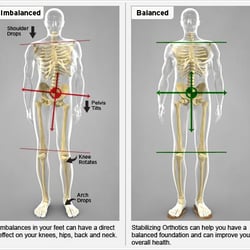 Michael G Robbins, DC - Individualized  chiropractic treatments and our custom made Orthotics we can correct foot, ankle, leg, hip, knee and back pro...