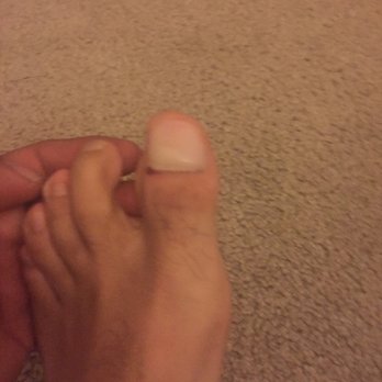Performance Foot and Ankle - Podiatrists Near Me - Thousand Oaks, California Performance Foot and Ankle - Podiatrists Near Me - Thousand Oaks, California