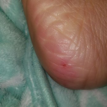 Le Nails - My heal was literally bleeding - Nail Salons Near Me - Ithaca, New York