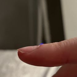 Eden Nail & Spa - Filed my mail down so far you can see the ridge. hurt so bad when she did this but continued going
