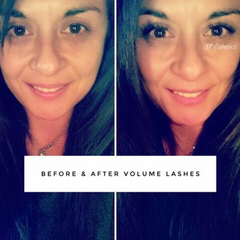 JP Esthetics - Skin Care Near Me - Manchester, Tennessee