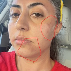 Skin By Sheba - After peeling with Sheba Sheba's worse job Looking my face !!!!!! Unbelievable is horrible before I had nice skin DO NOT USE THIS PALCE