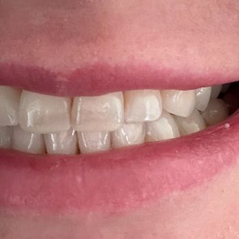 Las Vegas Braces - Orthodontists Near Me - Las Vegas, Nevada Las Vegas Braces - Orthodontists Near Me - Las Vegas, Nevada