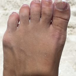 New Image Nails - Chipping and lifting on several -- missing one - Nail Salons Near Me - Middletown, Delaware