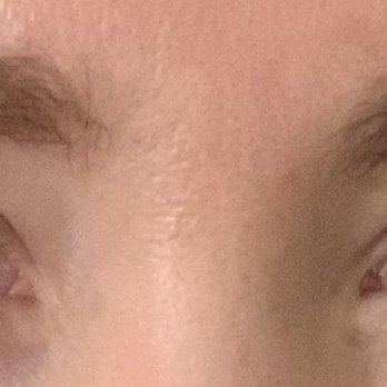 Elke Von Freudenberg Salon - Before pic - Hair Removal Near Me - New York, New York Elke Von Freudenberg Salon - Before pic - Hair Removal Near Me - New York, New York