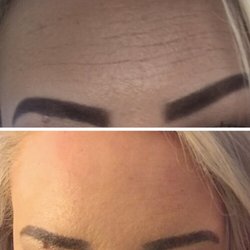 Reflections Medical - Botox