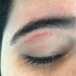 Glitzy Brows - Scabbed over the next day