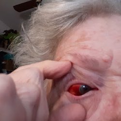 Retina Consultants of Nevada