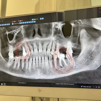 Los Olivos Dentistry - General Dentistry Near Me - Irvine, California Los Olivos Dentistry - General Dentistry Near Me - Irvine, California