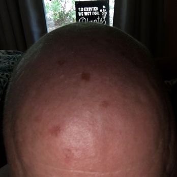 Advantage Dermatology - Dermatologists Near Me - Jacksonville, Florida