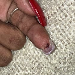 Cut the top of my finger off