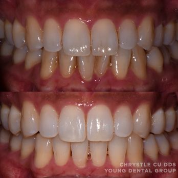 Chrystle Cu, DDS - General Dentistry Near Me - San Mateo, California Chrystle Cu, DDS - General Dentistry Near Me - San Mateo, California