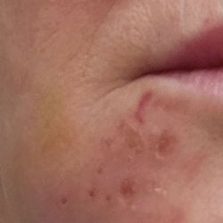 Dermatology and Laser Centre of Simi Valley