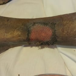 Lower Limb Institute: Mina Abadeer, DPM
