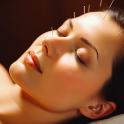 My Wellbeing Acupuncture