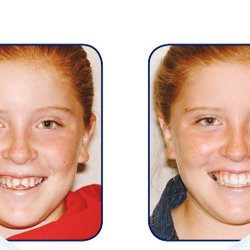 Crest Dental Group