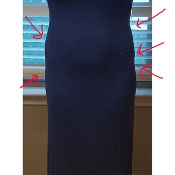 Beleza Surgery - Lumps on the hips and on my stomach. - Medical Spas Near Me - Cedar Park, Texas