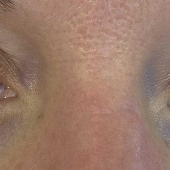Stephs Skin Studio - Day Spas Near Me - New Port Richey, Florida Stephs Skin Studio - Day Spas Near Me - New Port Richey, Florida
