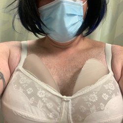 Massachusetts General Hospital Plastic Surgery - This is what a tried on , what I thought I was getting put in. Its a completely different type of implant