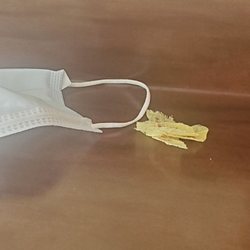 White Oak Manor-Charleston - This is some of the gauze that was in his bandage. It also was there for 2 days.