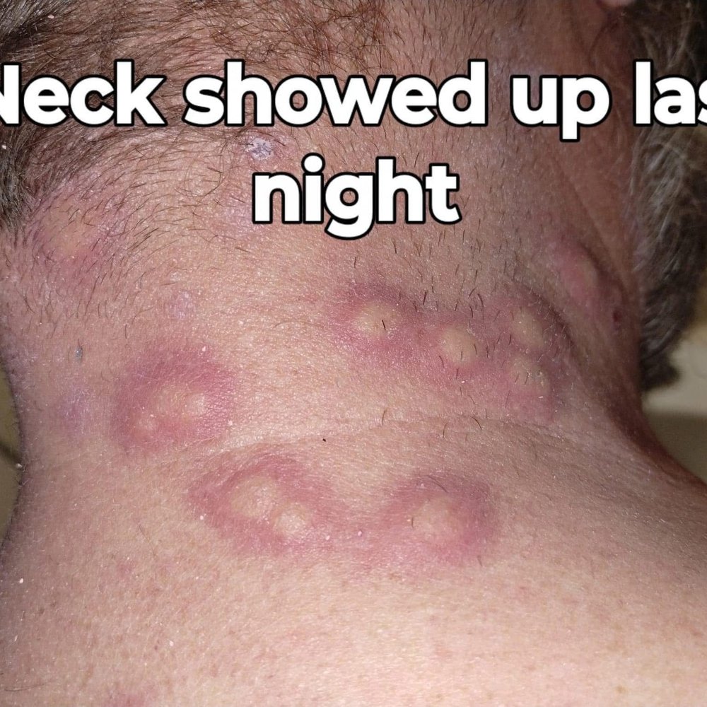 This is my brother-in-law's neck This is my brother-in-law's neck